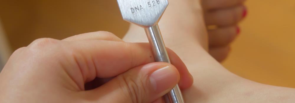 Tuning Fork Reflexology in London — What It Is, and an Honest Look at the Evidence for Each Half